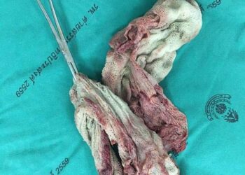 Lãnh đạo bệnh viện công ở Lào thừa nhận sai sót nghiêm trọng