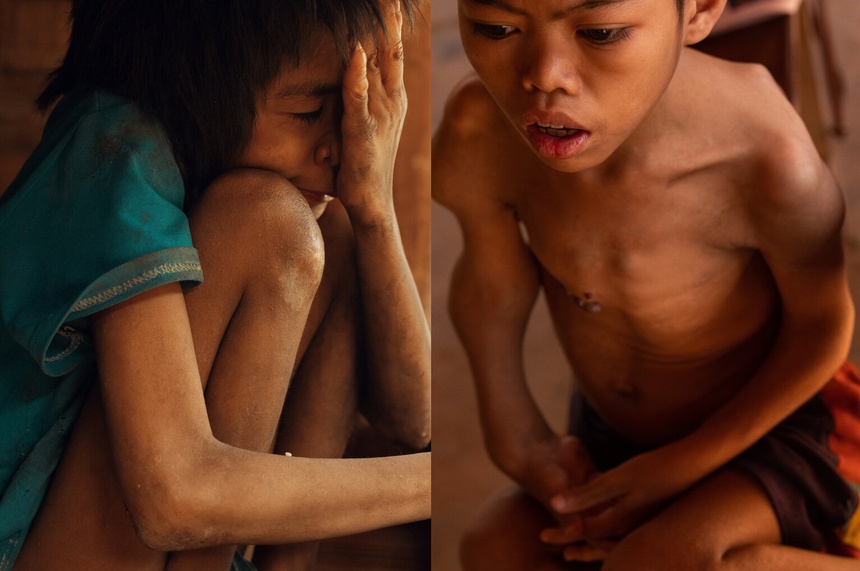 nan nhan chat doc da cam o Lao anh 2