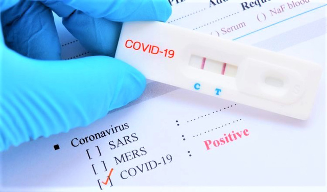 Lào cho phép sử dụng test nhanh Covid-19